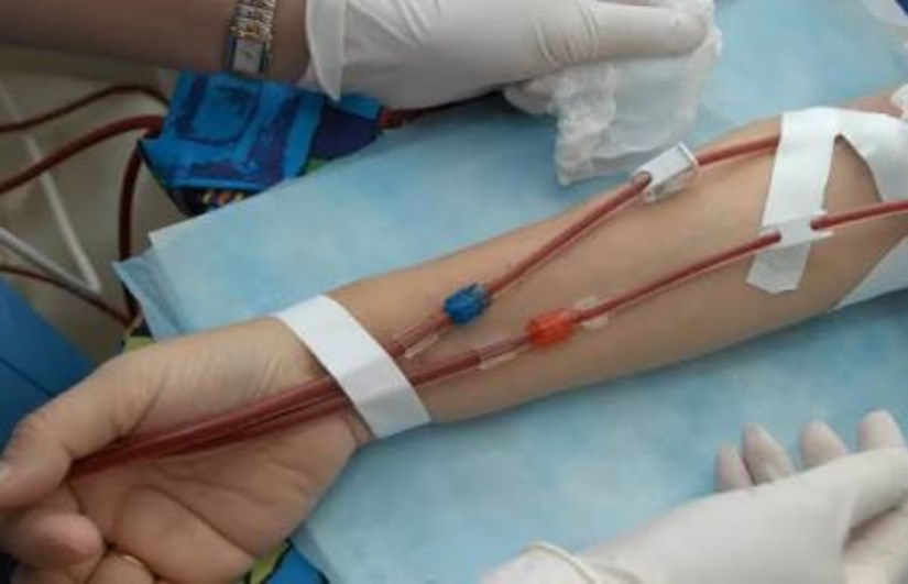 أخبار السودان 31 تشغيل 76 مركزاً لغسيل الكلى في كل الولايات – اون سودان